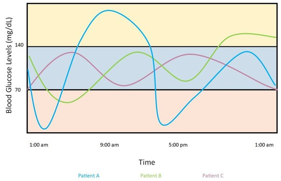 Glucose sensor algorithm